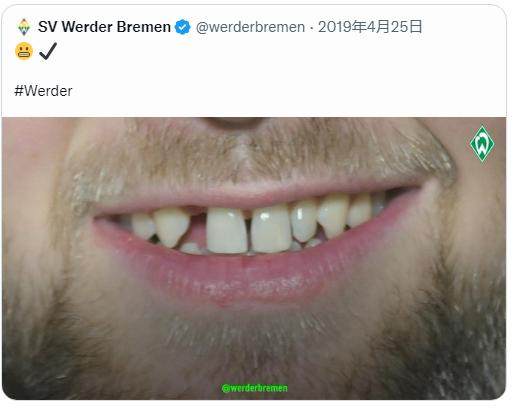 注册入口-【人物】德国豁牙救星！被K神钦点又放弃的晚成中锋